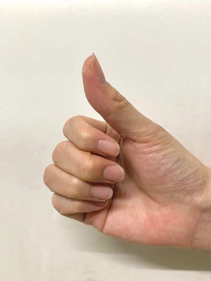 Ладони. Rough finger. Rough finger. Текстура отпечатки пальцев на стекле. Возрастные изменения ногтей на руках фото.