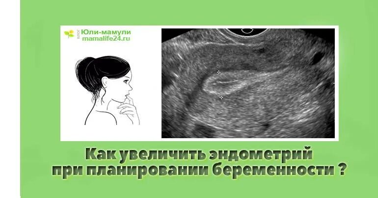 Какая должна быть эндометрия для зачатия. Толщина эндометрия нарастить. Как нарастить эндометрий. Лекарства для наращивания эндометрия в матке. Как нарастить эндометрий быстро.