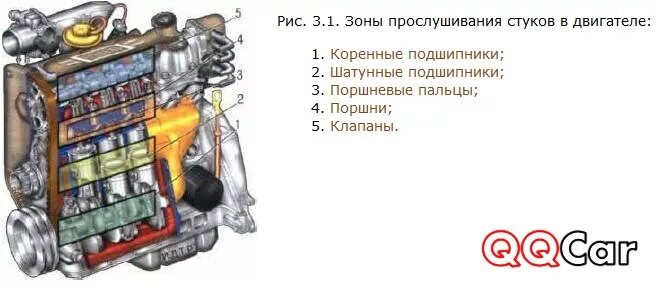 Почему стучит мотор. Схема зон прослушивания стуков в двигателе. Зоны прослушивания шумов в двигателе. Зоны прослушивания ДВС. Зоны прослушивания стуков в ДВС.