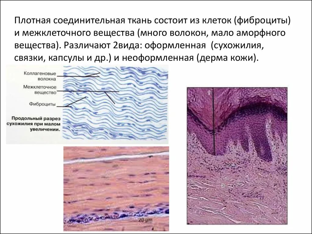 Плотная волокнистая неоформленная соединительная ткань. Плотная неоформленная соединительная ткань гистология. Плотная волокнистая соединительная ткань гистология. Плотная волокнистая неоформленная соединительная ткань рисунок.