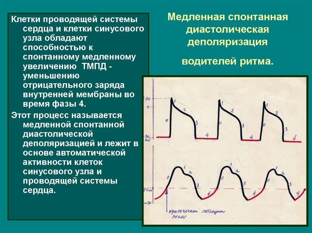 Медленная диастолическая деполяризация