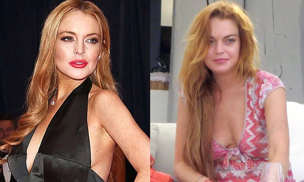 Линдси лохан до и после пластики Meidän Superstars VANISHED Tässä 15 Eniten Mind-Boggling Celeb Clone teorioita /