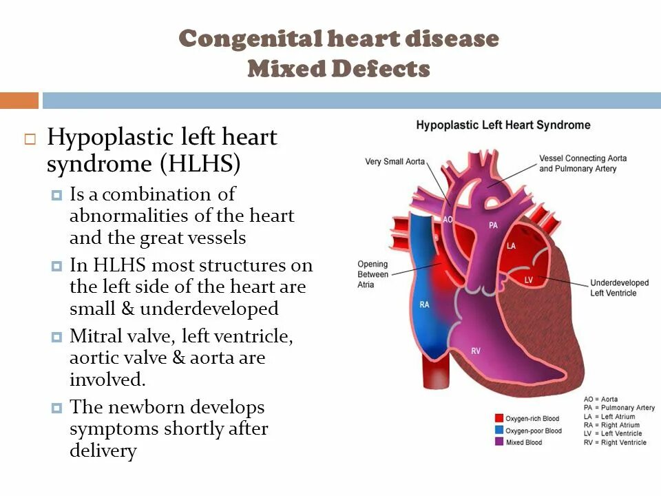 Дефекты межпредсердной и межжелудочковой перегородки. Congenital heart disease. Congenital heart disease. Congenital heart disease. День распространения информации о врождённом пороке сердца.