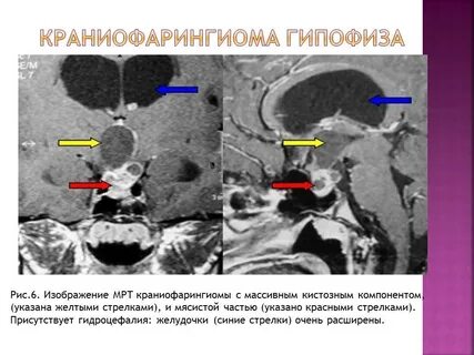 Мрт диффузия всего тела онкологический скрининг