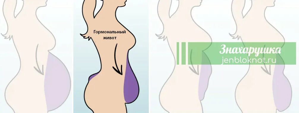 Гормональный животик. Гормональный животик у женщин. Растет гормональный живот. Стрессовый и гормональный живот.