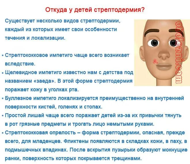 Стрептодермия у детей: 9 симптомов, формы, 15 методов лечения, обзор 6 препарато