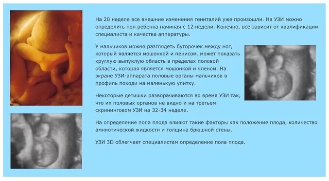 Пол ребенка неделя. На каком сроке можно определить пол ребенка. на какой неделе можно определить пол ребенка. na kakom sroke mozhno opredelit pol rebenka. на вкрм сроке модер узнать пол.