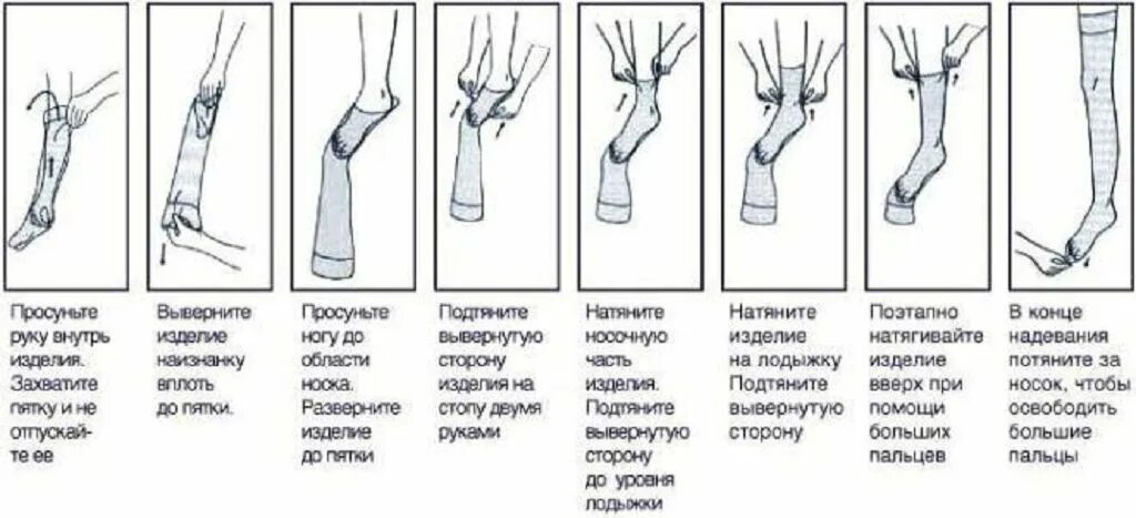 Сколько дней после операции носят компрессионные чулки. Как правильно надевать компрессионные чулки 1 класса. Как одевать компрессионные чулки перед операцией. Как одевать компрессионные чулки 1 класса. Как надеть компрессионные чулки 1 класса.