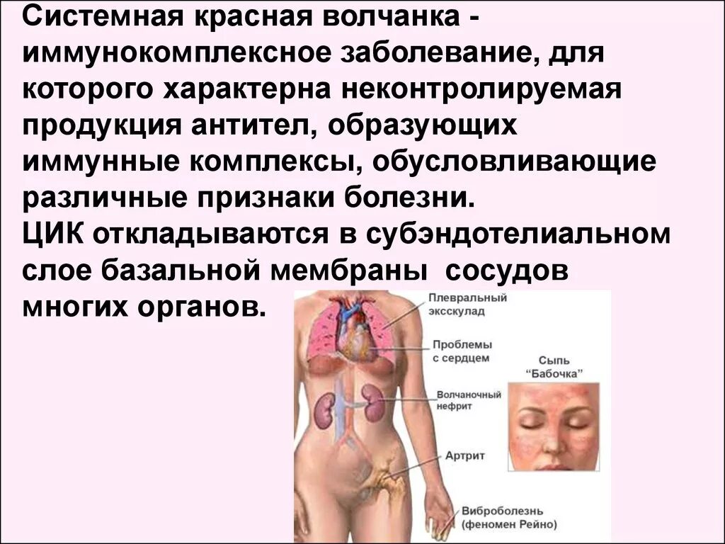 Медицинский Центр - Иммунокоррекции им. Ходановой Р.Н. - Красная волчанка