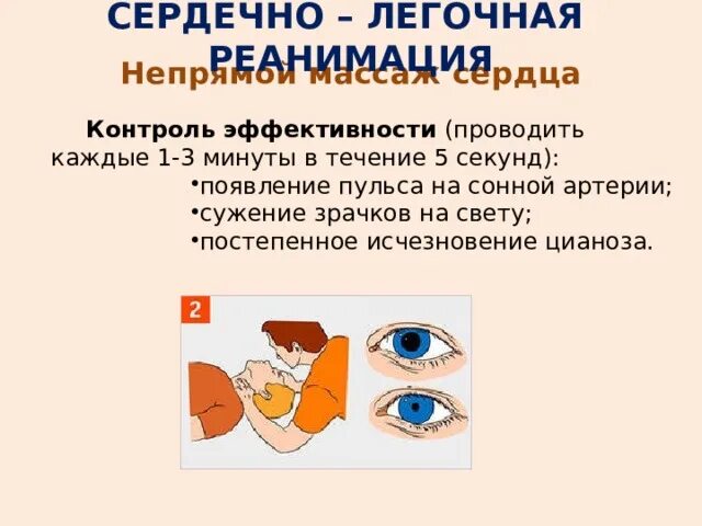 Что свидетельствует об эффективности непрямого массажа сердца. Первый критерий эффективности проводимого непрямого массажа сердца:. при.слр зрачок сужается. непрямой массаж реакция на свет. непрямой массаж сердца зрачок с сужается при проверке.