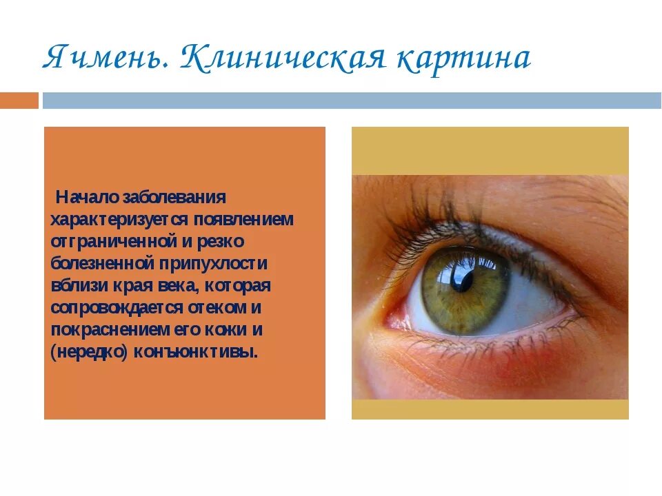 Как быстро вылечить ячмень у взрослого. Заболевания век ячмень. Клинические проявления ячменя. Этапы развития ячменя на глазу. Этапы формирования ячменя на глазу.