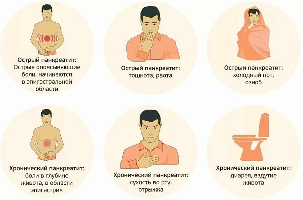 признаки приступа панкреатита у женщин симптомы.