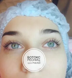 Минусы ботокса для лица