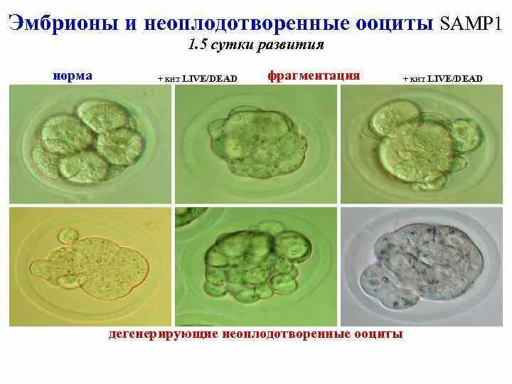 Сколько эмбрионов форум. Фрагментация эмбриона. Фрагментированный ооцит. Фрагментация эмбрионов на 5 день. Неоплодотворённые эмбрион.