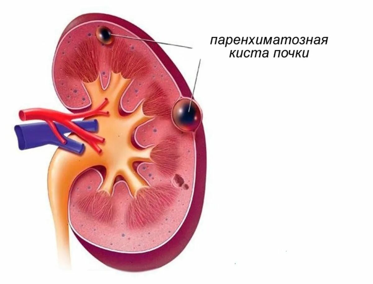 Почка округлой формы