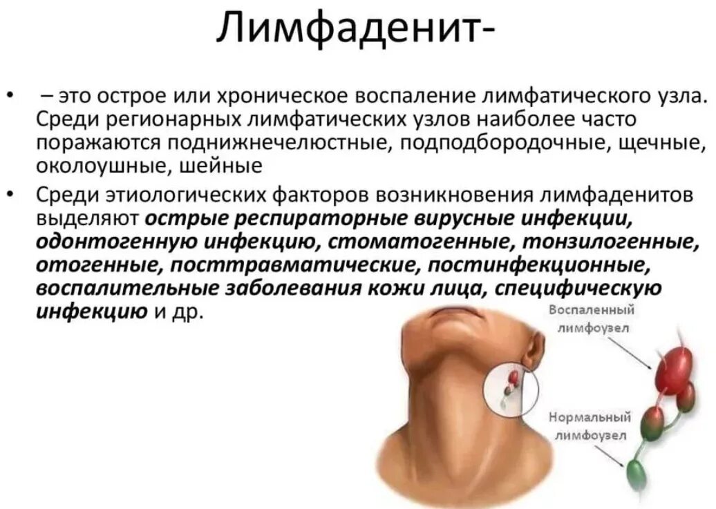 Окружающее болезненный. Воспаление околоушного лимфатического узла. Острый неспецифический лимфаденит клиника. Воспаление лимфатических узлов симптомы. Поверхностные шейные лимфоузлы воспаление.