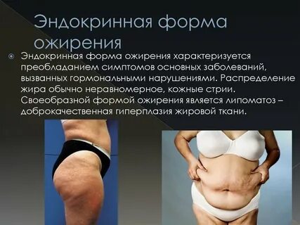 Гормоны у женщин влияющие на лишний