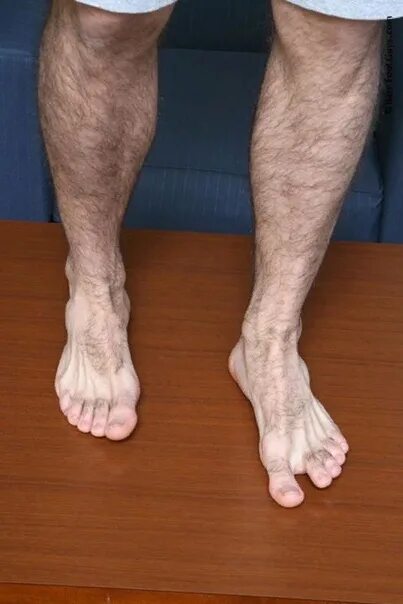 Как выглядят ноги у мужчин