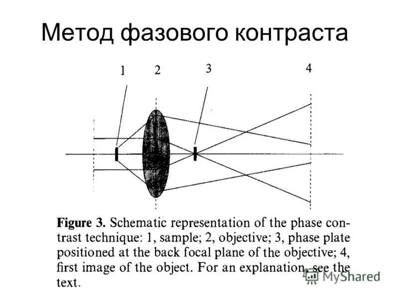 позыва контрастная микроскопии. фазово-контрастная микроскопия принцип. метод фазового контраста. метод фазового контраста. фазово-контрастная микроскопия микробиология.