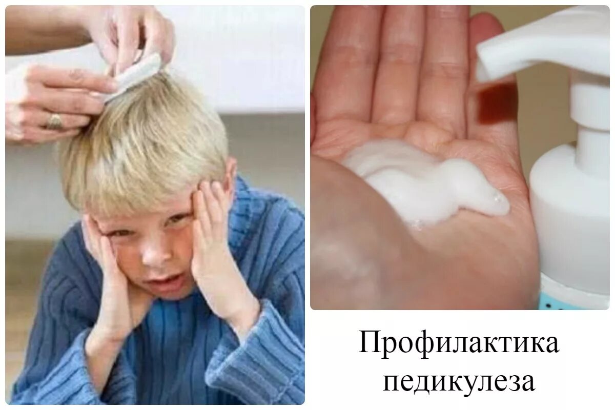 Профилактика при педикулезе. Схема лечения при педикулезе. Профилактика педикулеза памятка. Педикулёз у детей профилактика в детсаду. Профилактика педекулез.