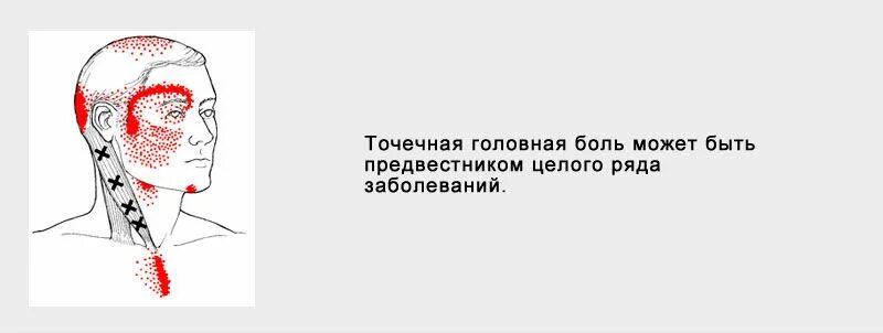 Боль в левом лбу. Б РЛИТ годовпв одной точке. Болит голова в одной точке. Голова болит в одной точке на лбу.