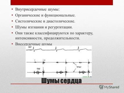 Шумы в сердце это