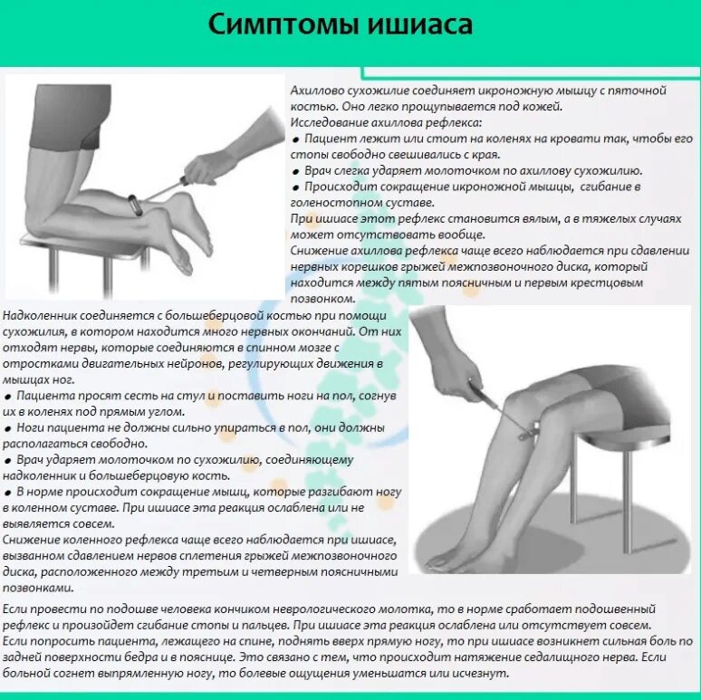 Что происходит при защемлении седалищного нерва. Седалищный нерв симптомы. при седалищном нерве симптомы. ишиас седалищного нерва симптомы. ишиас - защемление седалищного нерва.