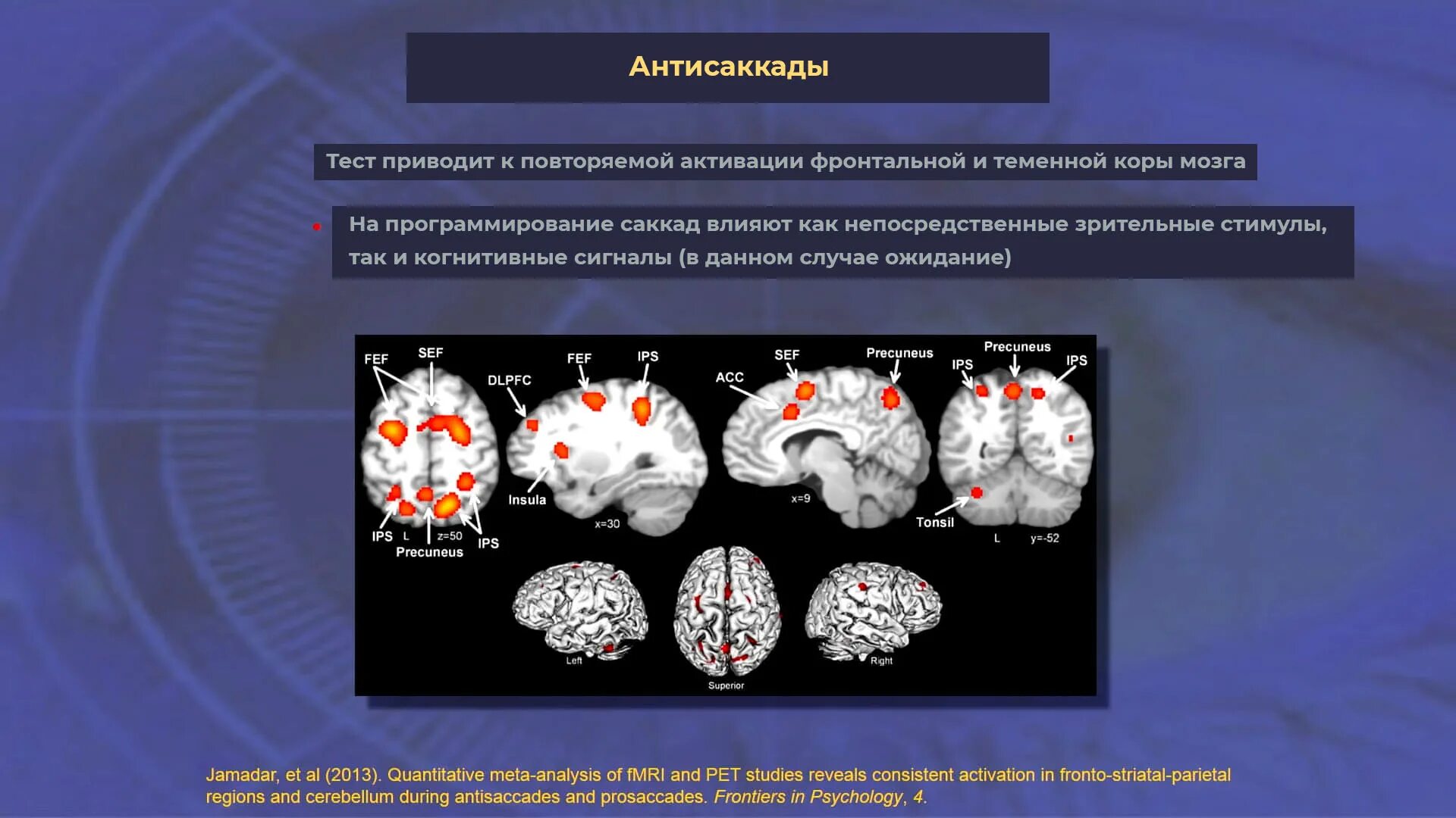 Синдром визуального снега. Синдром визуального снега фонари.