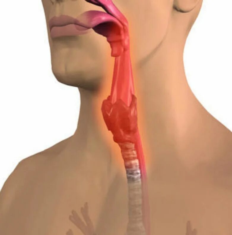 Новообразования в глотке. Глотка трахея пищевод