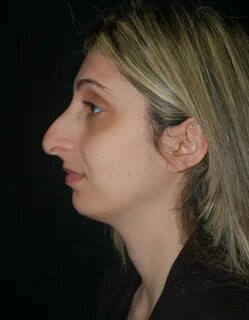 Big nose