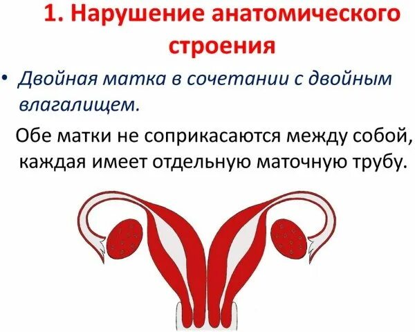 Может ли быть две матки. Две матки у женщин. удвоение матки и беременность. патология удвоение матки.