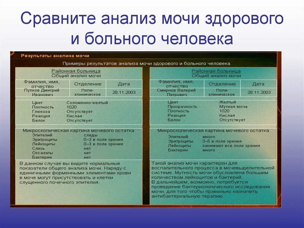 Показатели заболевания почек. Анализы мочи при заболеваниях почек. Анализ мочи при патологии почек. Общий анализ мочи при заболеваниях почек. Анализ мочи при заболевании почек показатели.