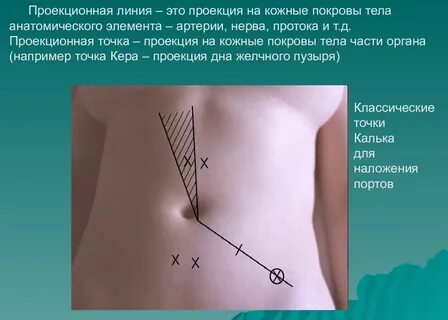 Кратчайшая линия проведенная по поверхности