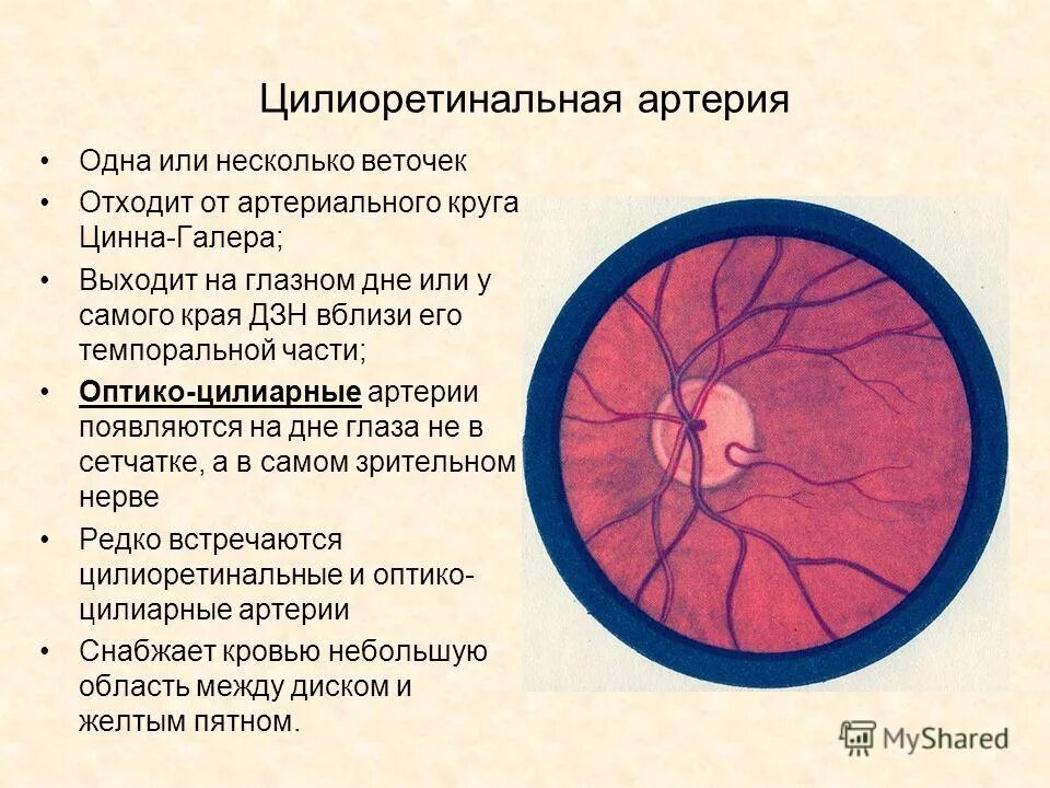 Кровообращение сетчатки. Цилиоретинальная артерия. окклюзия цилиоретинальной артерии. кровоснабжение глазного дна. кровоснабжение сетчатки глаза.