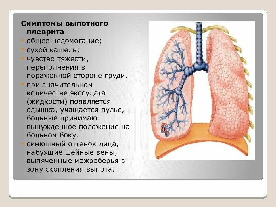 Алеврит. Плевральные изменения в легких что это. Плевральные осложнения