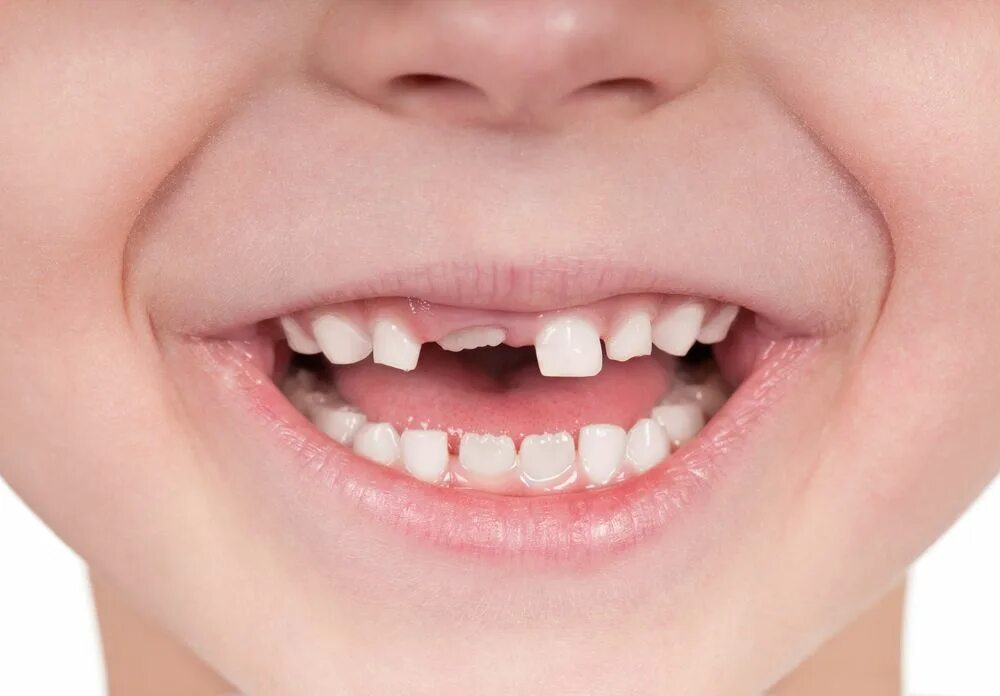 Dental Health & Kids: A Guide for Every Age Live Science