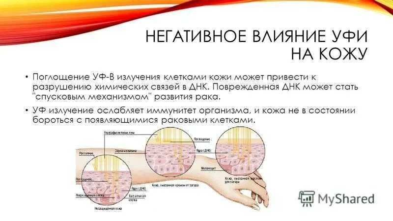 Влияние ультрафиолетового излучения на кожу. Воздействие УФ лучей на кожу. Воздействие солнечных лучей на кожу человека. Солнечное излучение и влияние на кожу. Радиация кожи