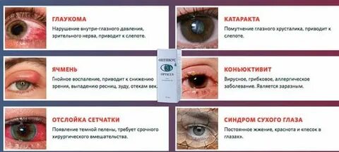 Болезнь сухости глаз