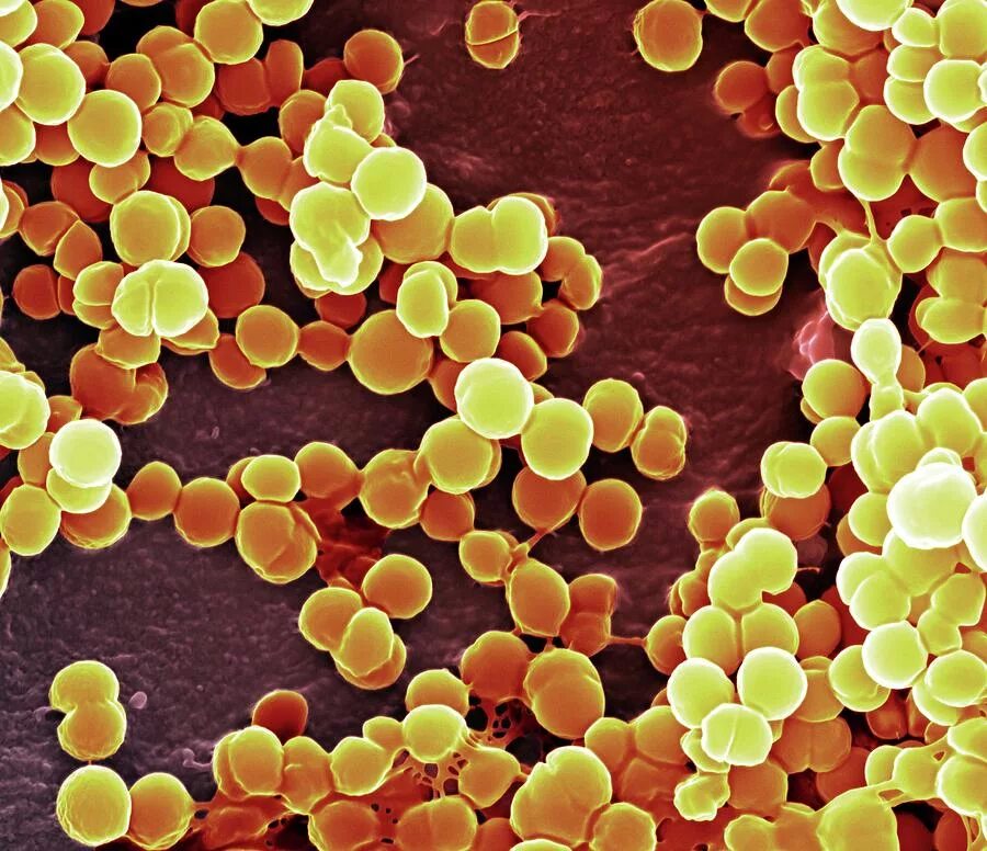 Staphylococcus aureus золотистый стафилококк. Метициллин-резистентный золотистый стафилококк. Стафилококк золотистый Staphylococcus aureus. Бактерия стафилококк ауреус. Стафилококк ауреус под микроскопом.