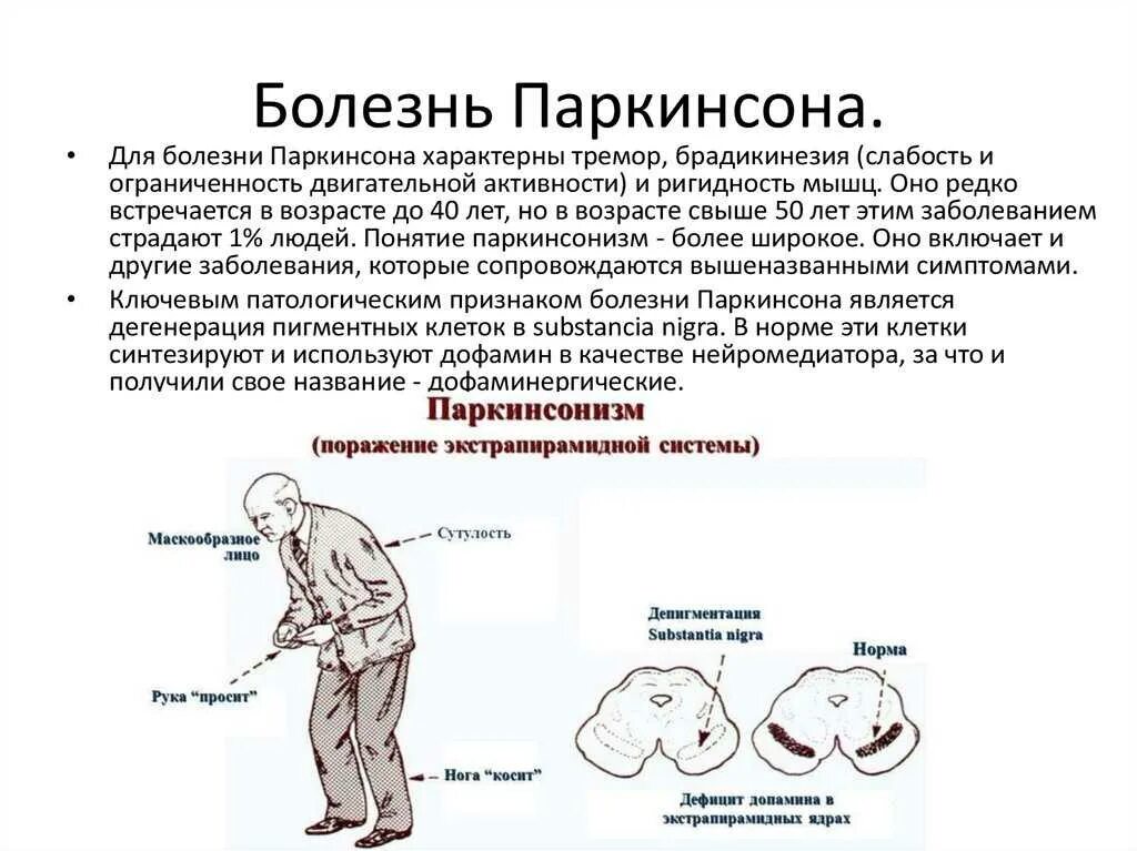 Паркинсонизм очаг поражения. Болезнь Паркинсона очаг поражения. Болезнь Паркинсона неврология. Недостаток какого медиатора наблюдается при болезни Паркинсона. Что такое болезнь паркинсона простыми словами симптомы