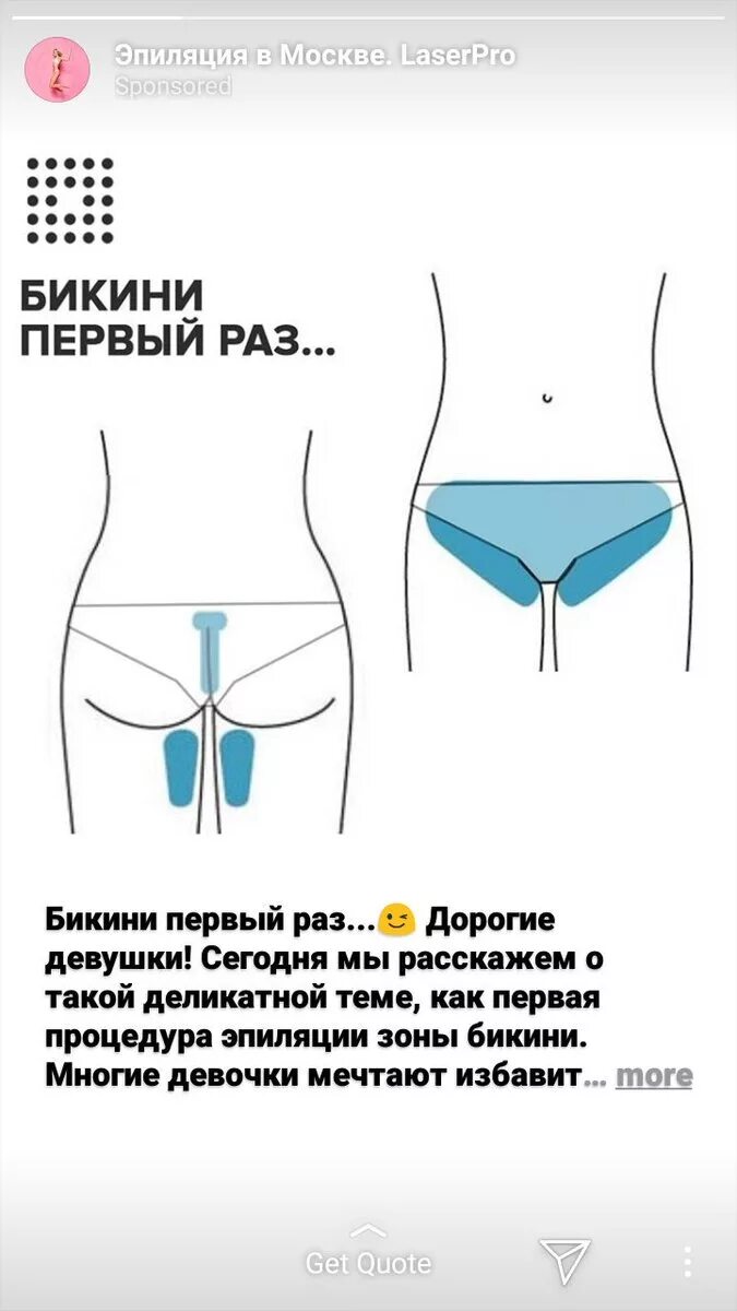 Чем отличается бикини от тотального бикини. Зона классического бикини. классическое бикини. депиляция зоны бикини. эпиляция бикини классика.