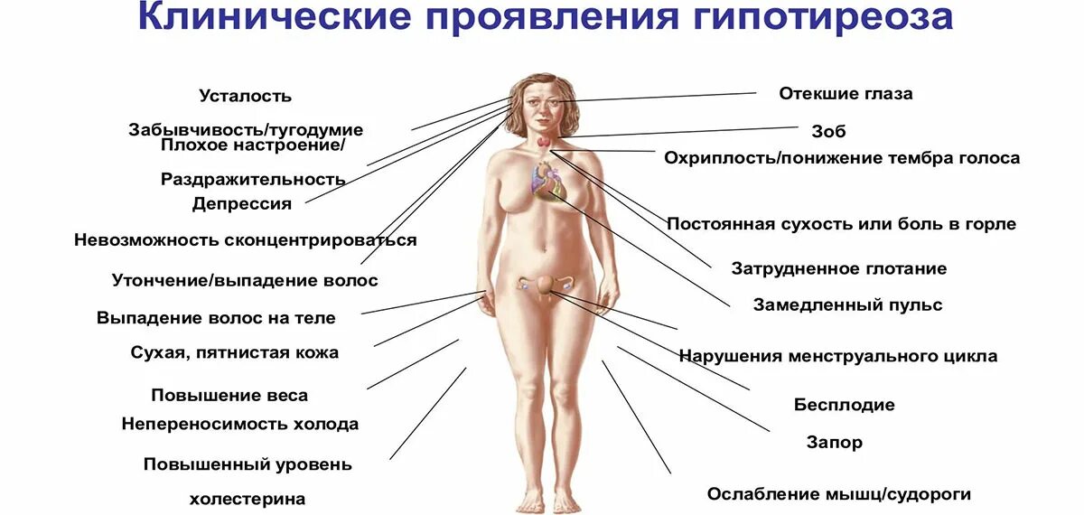 Синдром гипофункции щитовидной железы. Сниженная функция щитовидной железы. Снижение функции гормоны щитовидной железы. Клинические симптомы гипотиреоза. Гипофункция тиреотропного гормона