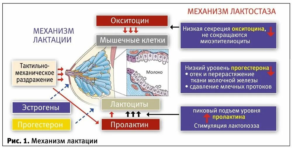 Что такое лактостаз
