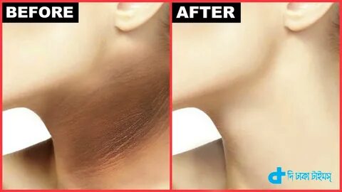 Getting neck