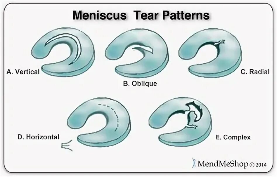 Муцин схема. Янтарные слёзы группа. Wiki tear. Полезны ли слезы для кожи лица. Tears of the angel logo.