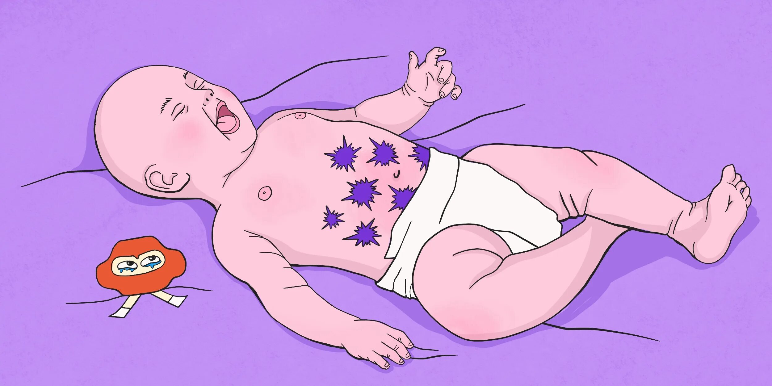 Фиолетовый плач новорожденного. Что такое колики у новорожденных. Фиолетовый плач у грудничка в 3 месяца. Позы при коликах у новорожденных. Почему колики у новорожденных