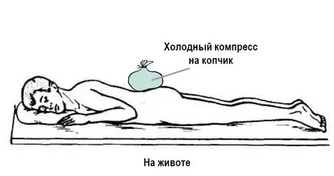 Лечение копчика