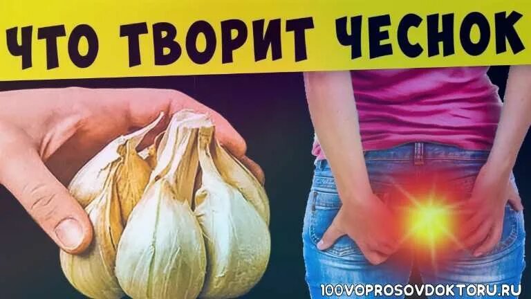 Можно ли есть чеснок при геморрое. Чеснок от геморроя. чеснок и геморрой. геморрой дольки чеснока. чеснок простатит.