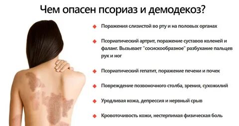 Проявление болезней кожи
