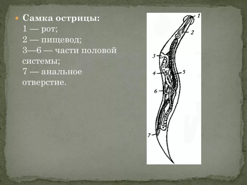 Пищевод 3 части. Бульбус пищевода у острицы. Острица строение. Строение острицы детской.